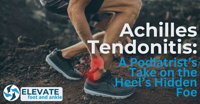 Achilles Tendonitis: A Podiatrist’s Take on the Heel’s Hidden Foe image