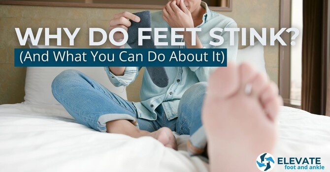 Why Do Feet Stink (and What You Can Do About It) image