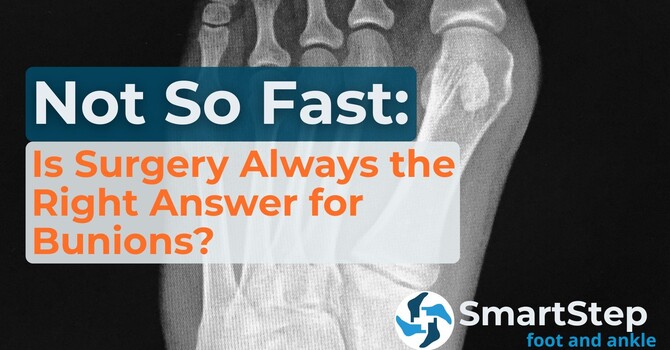 Not So Fast: Is Surgery Always the Right Answer for Bunions? image