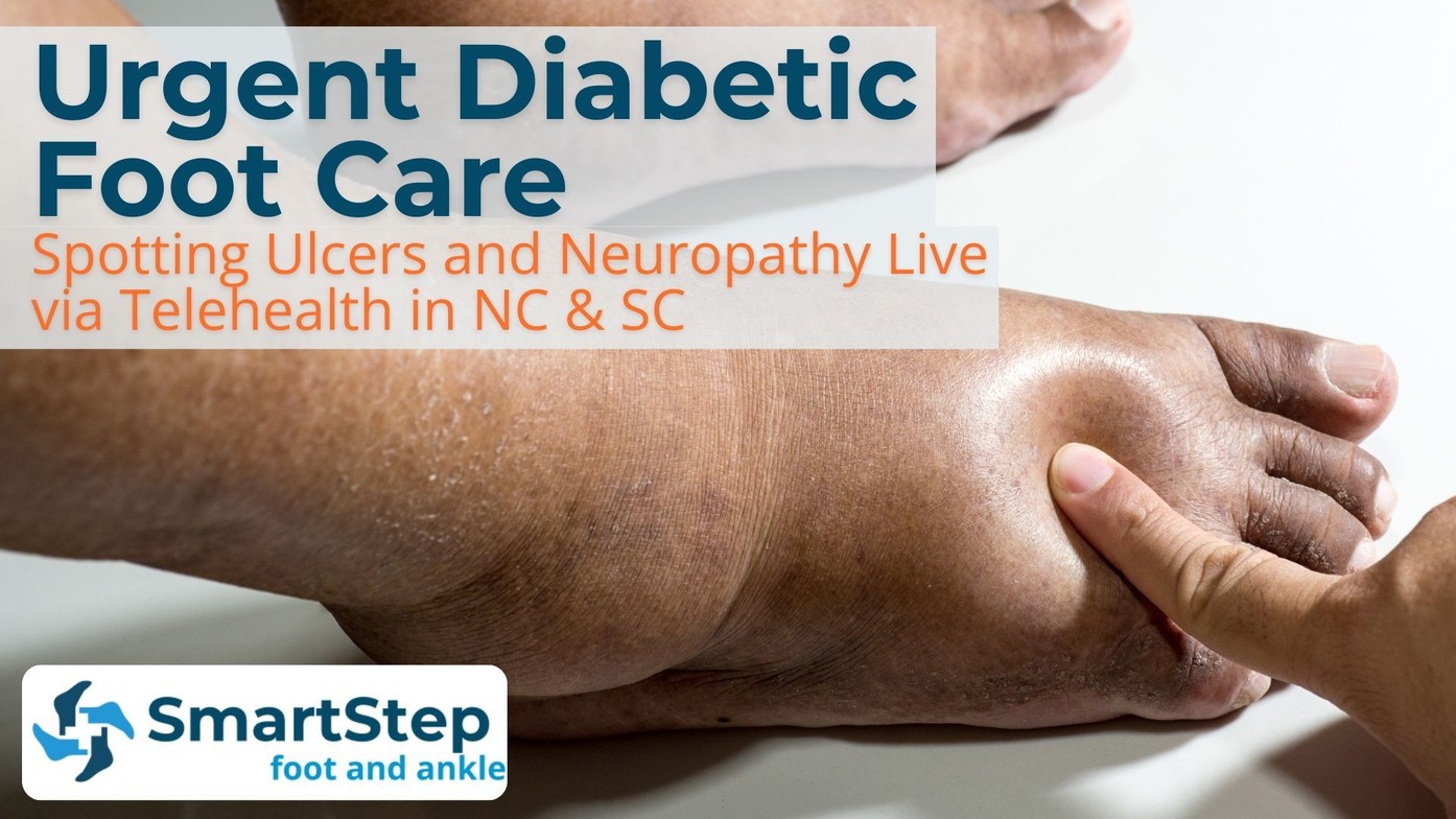 photo of a finger pushing on a diabetic foot with pitting edema and text