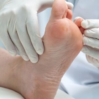 photo of a podiatrist examining a foot with a soft tissue mass in Fort Mill SC