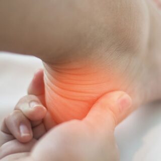 photo of an inflamed heel due to bone spurs